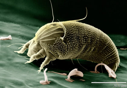 Mites